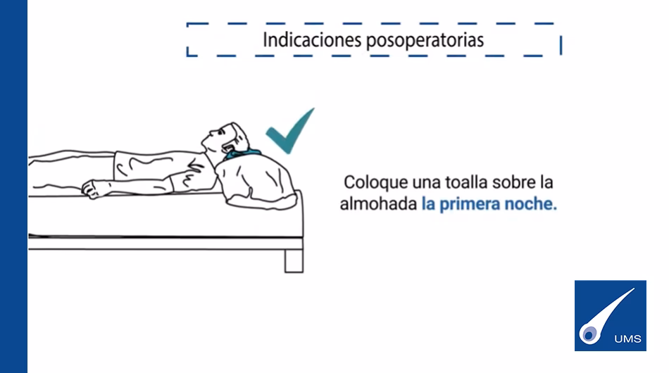¿Cuándo puedo dormir normal después de un injerto de pelo?