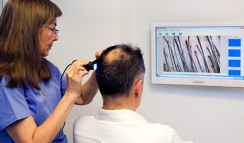 ¿Cuánto tiempo dura la caída del cabello después de la anestesia?