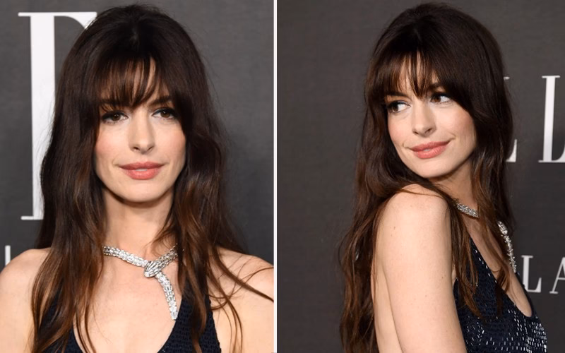 ¿Qué se hizo Anne Hathaway para verse más joven?