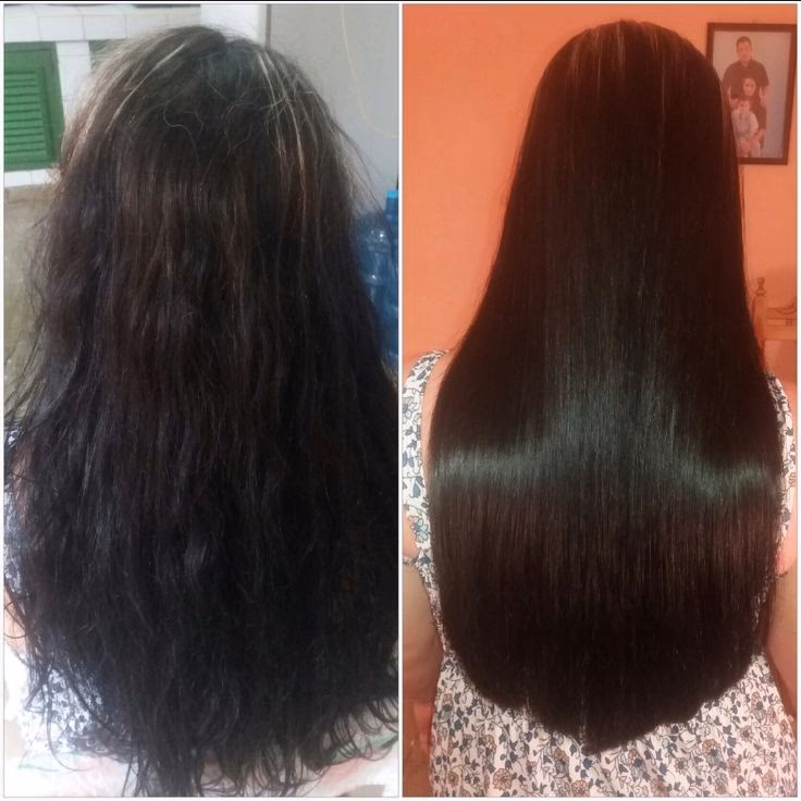 ¿Cuáles son las contraindicaciones del lifting capilar?