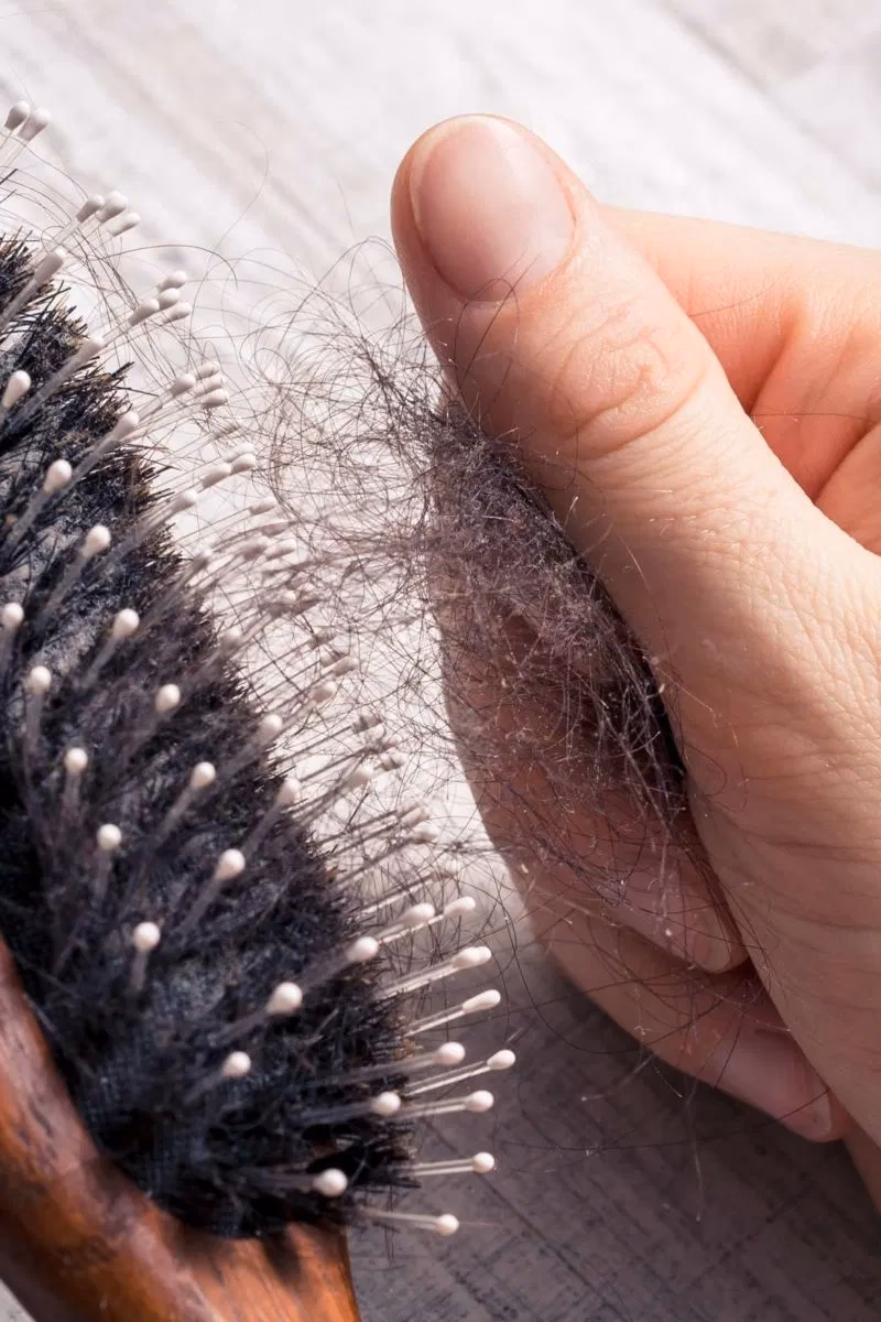 ¿La artritis reumatoide puede causar la caída del cabello?