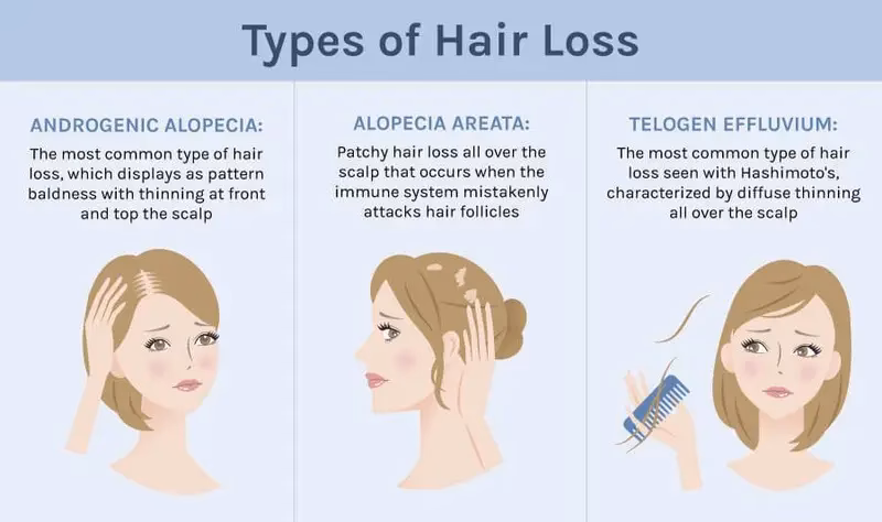 ¿Puede el Ayurveda tratar la caída del cabello?