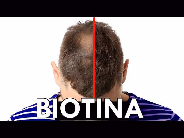 ¿Cuántos meses debo tomar biotina para el cabello?