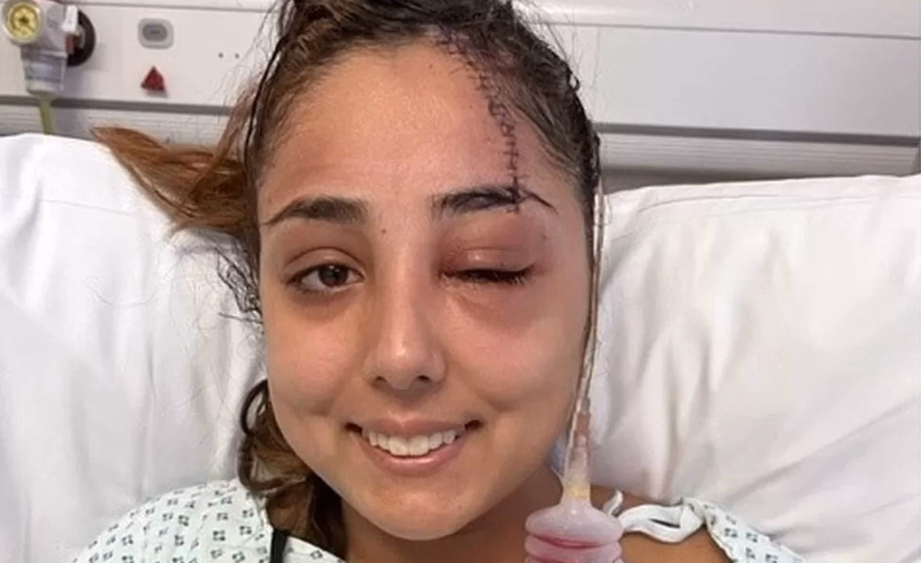 ¿Qué es la caída del cabello por rotura?