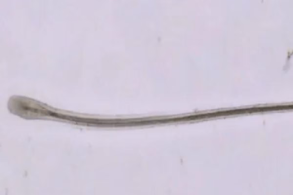 ¿Qué significa que el pelo se caiga con la punta blanca?