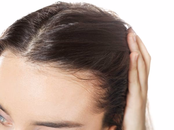 ¿Qué provoca la alopecia frontal?