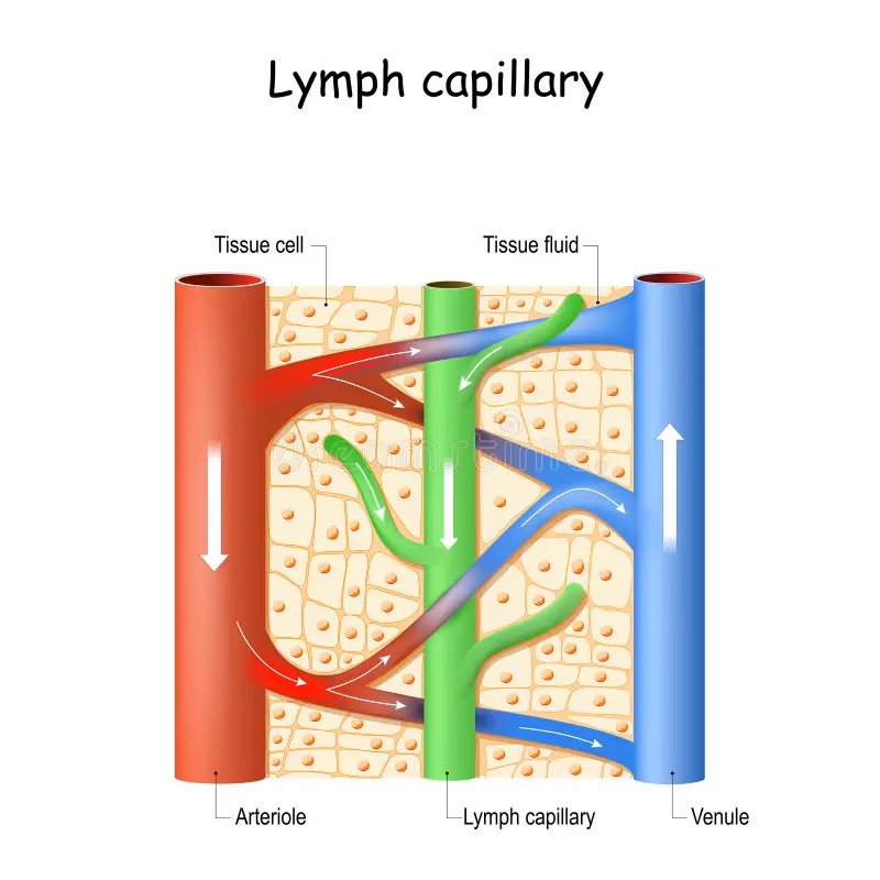 ¿Qué pasa si se bloquean los capilares linfáticos?