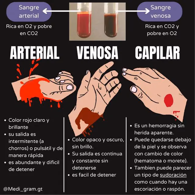 ¿Qué es un derrame capilar?