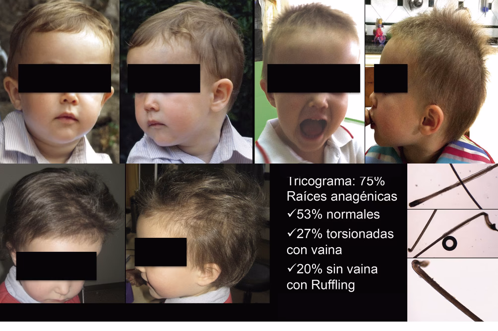 ¿Para qué sirve la tableta omim?