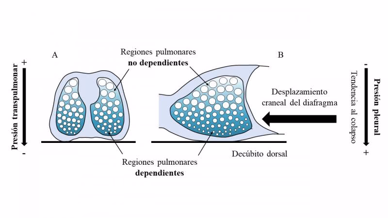 ¿Qué es la distensión alveolar?