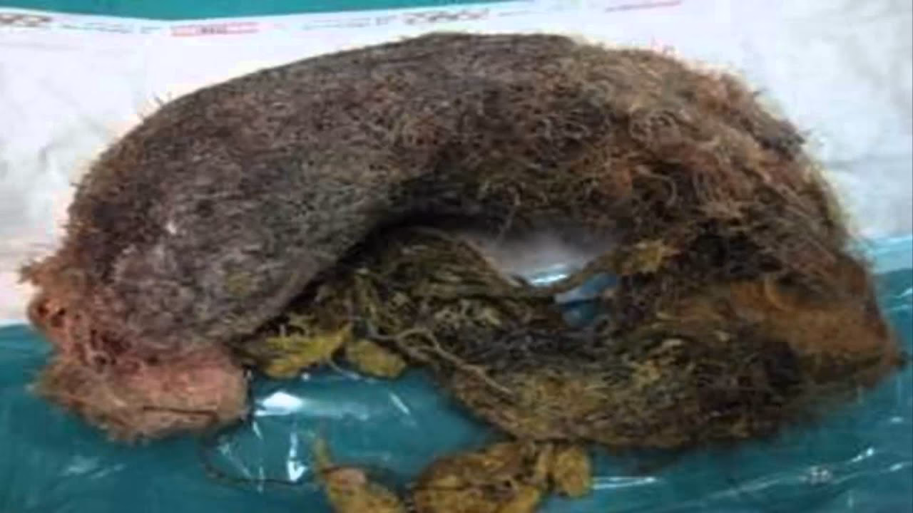 ¿Cómo curar la tricofagia?