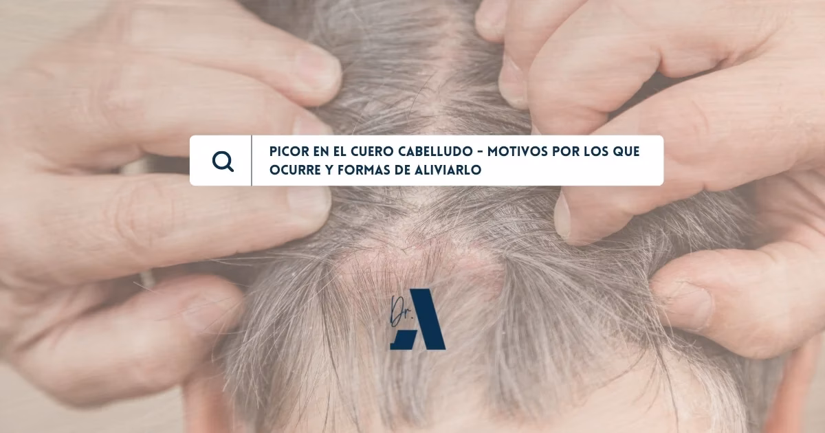¿Cuándo debo preocuparme por la picazón del cuero cabelludo?
