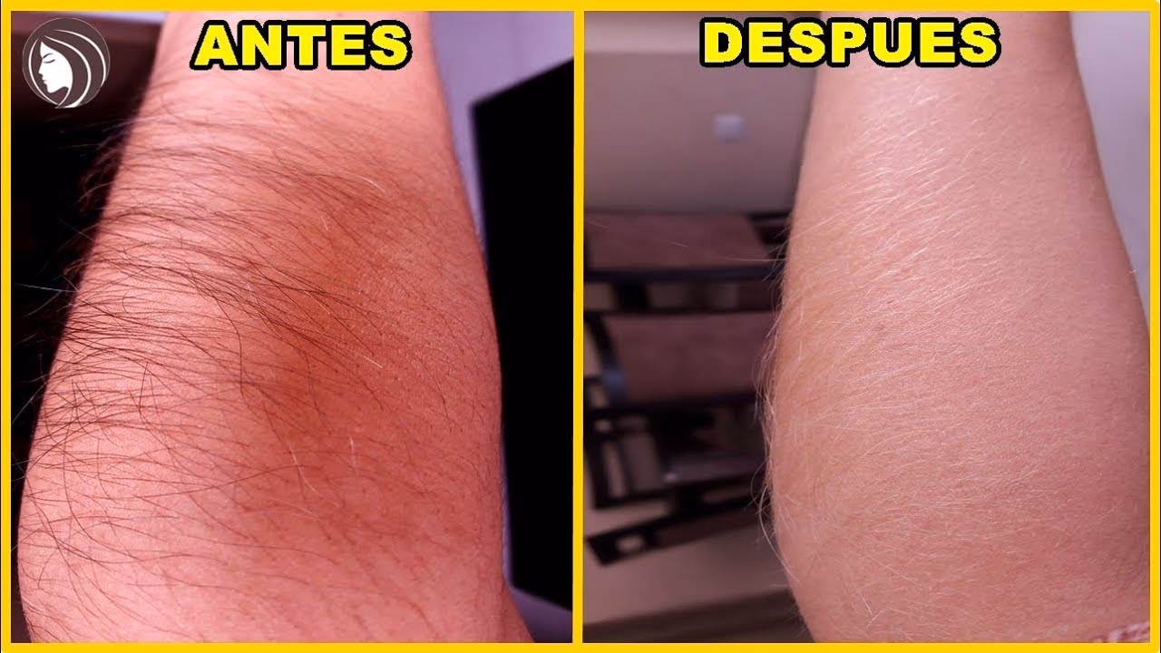 ¿Cómo aclarar los brazos con agua oxigenada?