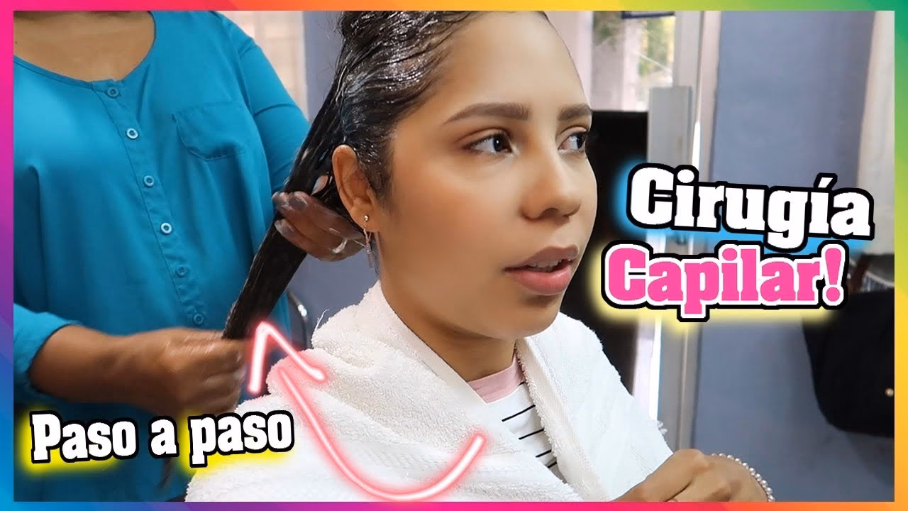 ¿Cómo se realiza la cirugía capilar?