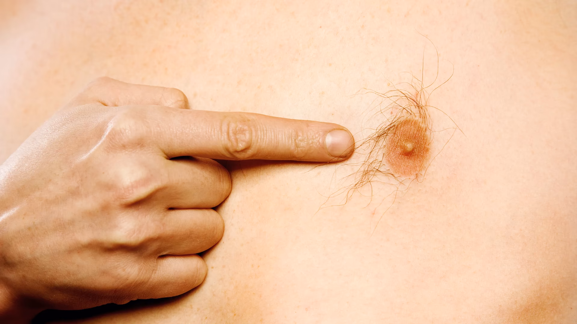 ¿Cómo sacar pelo en el pecho?