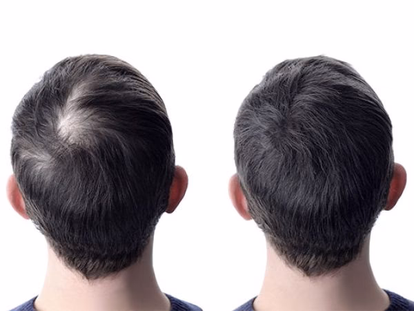 ¿Cómo tener un cabello más abundante?