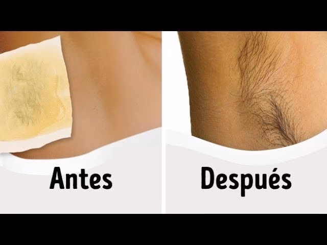 ¿Qué detiene el crecimiento del vello?