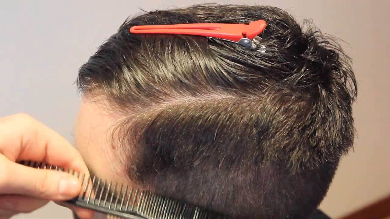 ¿Qué es una raya lateral profunda?