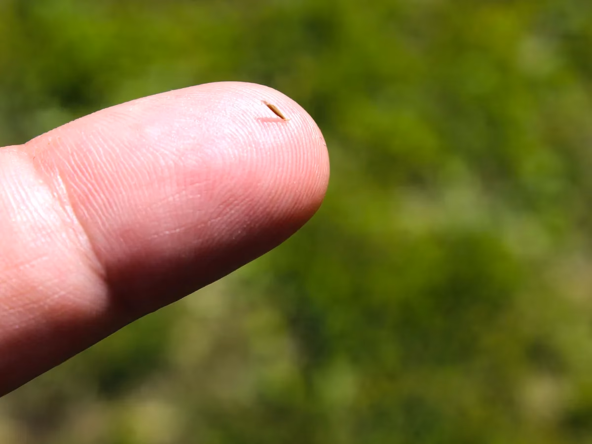 ¿Qué hacer si una astilla no sale?