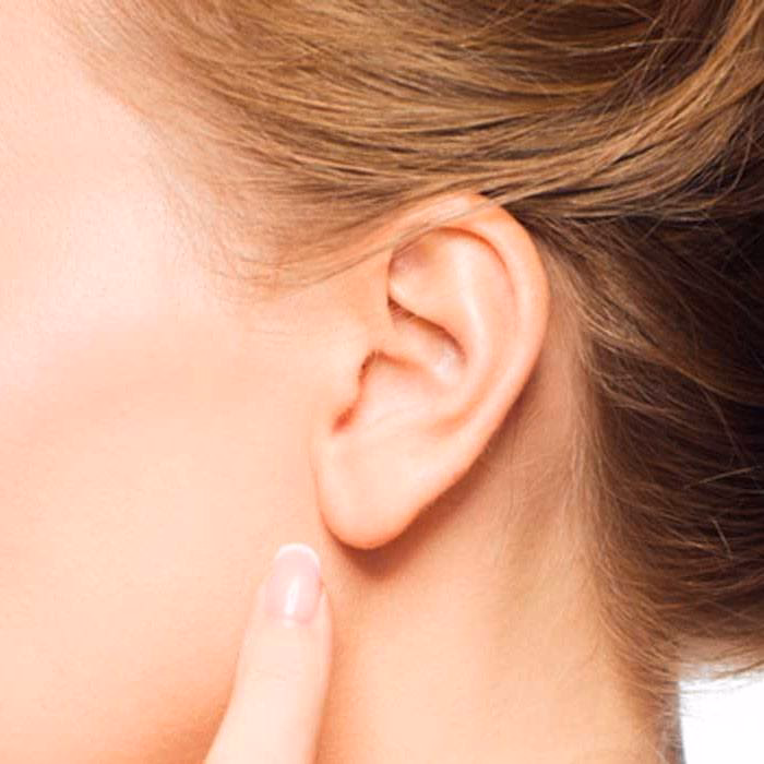 ¿Cómo se llama lo de las orejas?