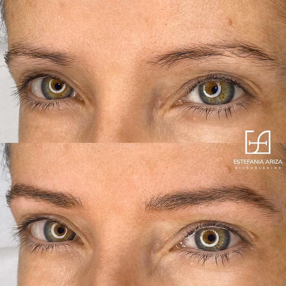 ¿Cómo se llama la técnica de poner pelos en las cejas?