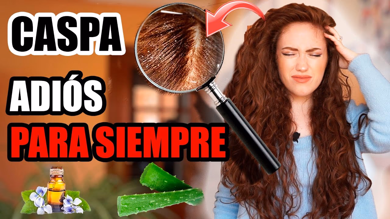 ¿Cómo lavar el pelo para que no salga caspa?