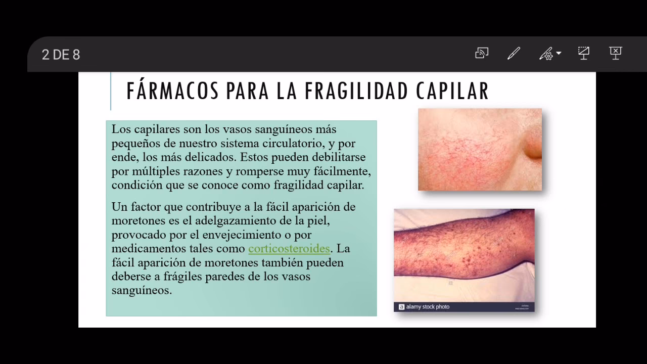 ¿Qué hacer cuando el cuero cabelludo está débil?