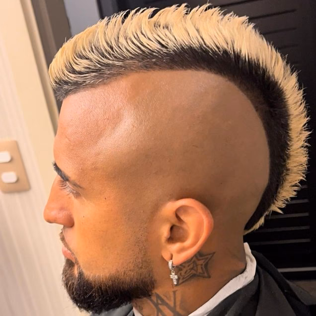 ¿Qué jugador chileno tiene una cresta?