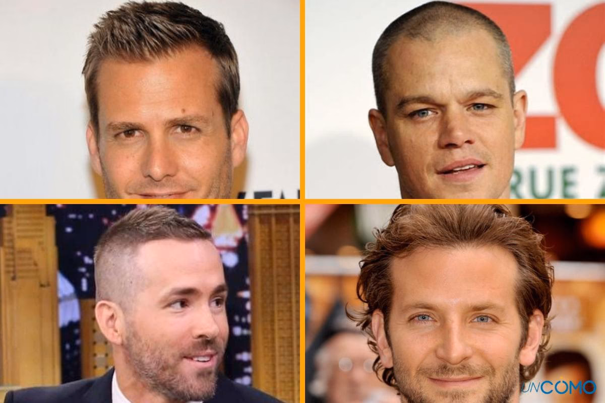 ¿Qué hacer si mi frente es muy grande?