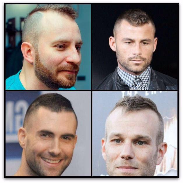 ¿Cómo ocultar una calva en un hombre?