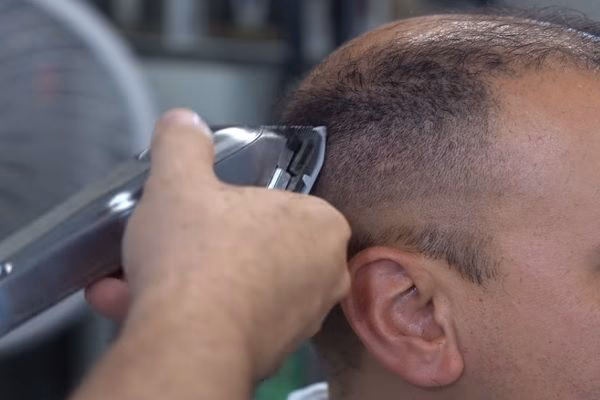 ¿Cuál es el mejor corte de pelo para disimular la calvicie?
