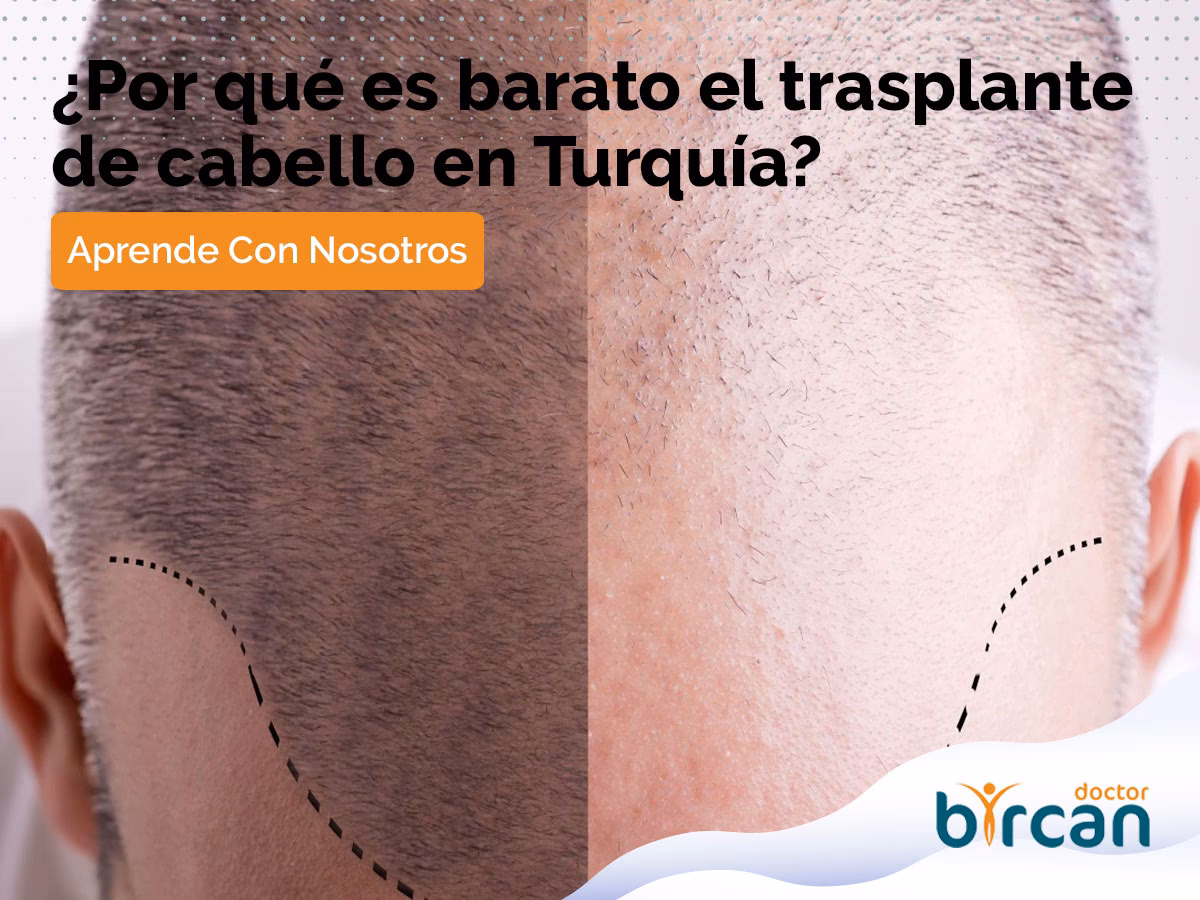 ¿Cuánto cuesta un injerto de cabello en Turquía?
