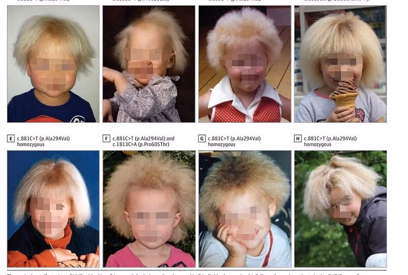 ¿Qué es lo que más estimula el crecimiento del cabello?