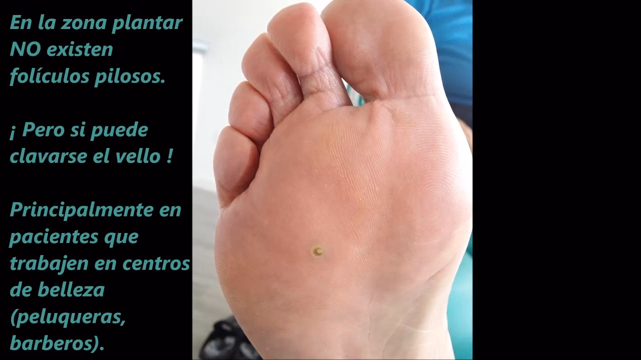 ¿Cómo saber si estoy en fase telogena?