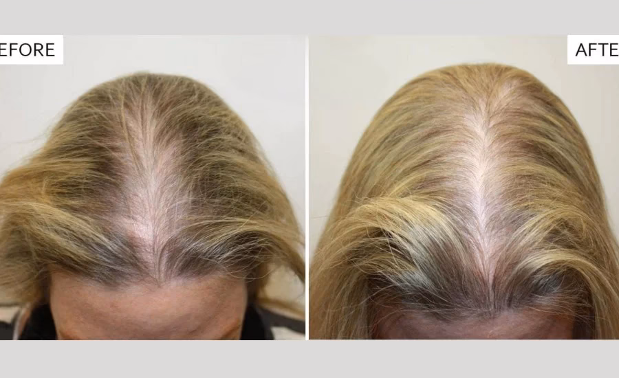 ¿Cómo descomponer el cabello más rápido?