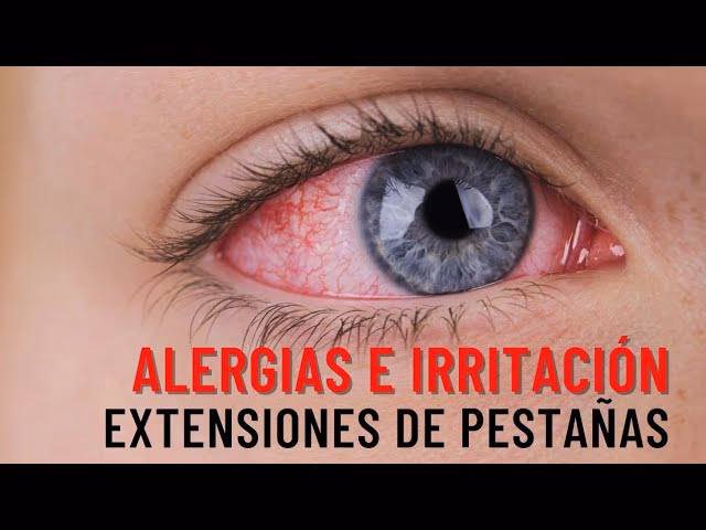 ¿Cómo puedo aliviar la alergia a las extensiones de pestañas?