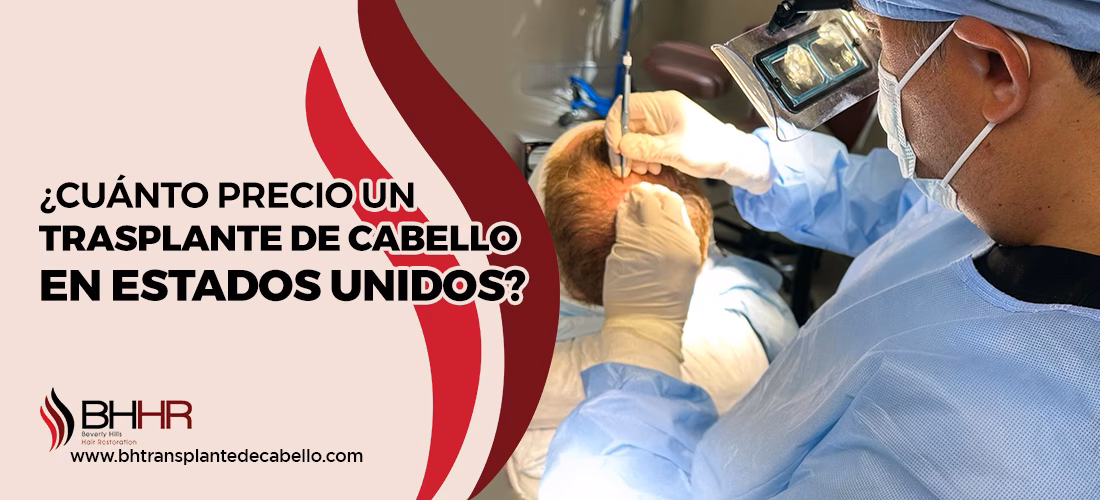 ¿Cuánto cuestan los implantes de cabello en Estados Unidos?
