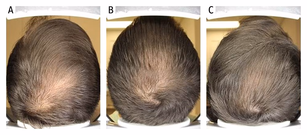 ¿Cuáles son algunos datos interesantes sobre el cabello?