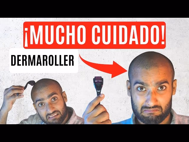 ¿Qué tan efectivo es el dermaroller para el crecimiento del cabello?