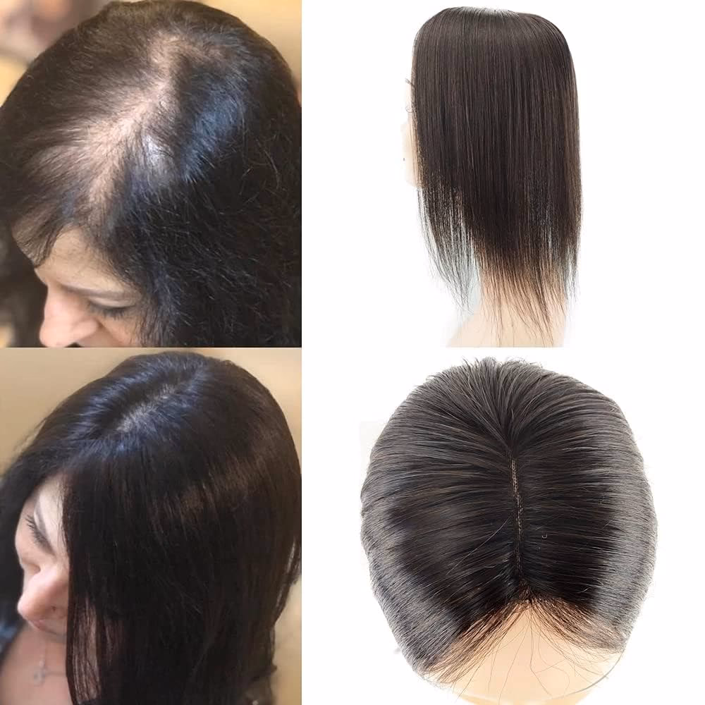 ¿Cuánto cuesta una prótesis para el cabello?