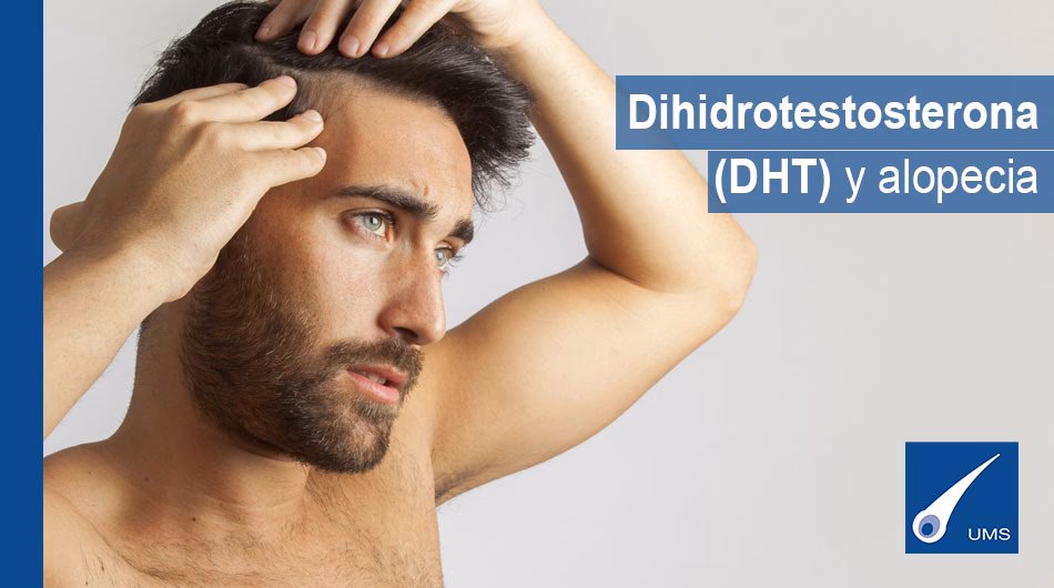 ¿Qué puede hacer la testosterona por tu cabello?