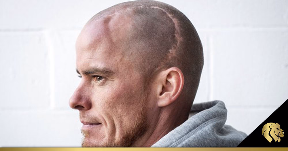 ¿Cuánto tarda en crecer el pelo en una cicatriz?