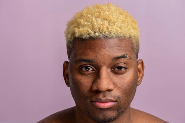 ¿Cómo fue el accidente de Jean-Claude Van Damme?