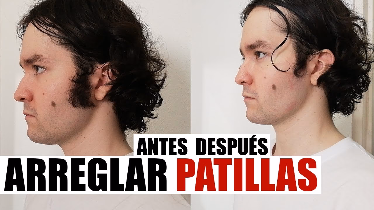 ¿Por qué estoy perdiendo pelo en mis patillas?