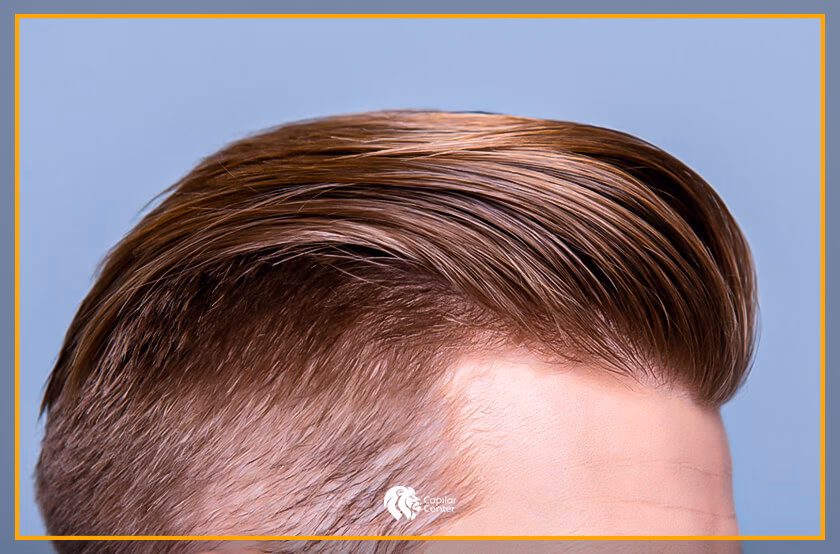 ¿El polvo provoca la caída del cabello?