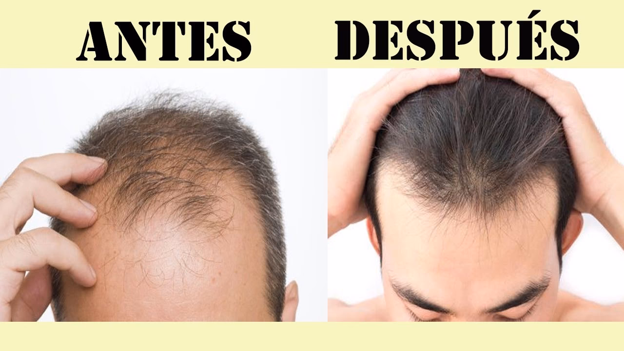 ¿Qué tipo de alcohol es malo para el cabello?