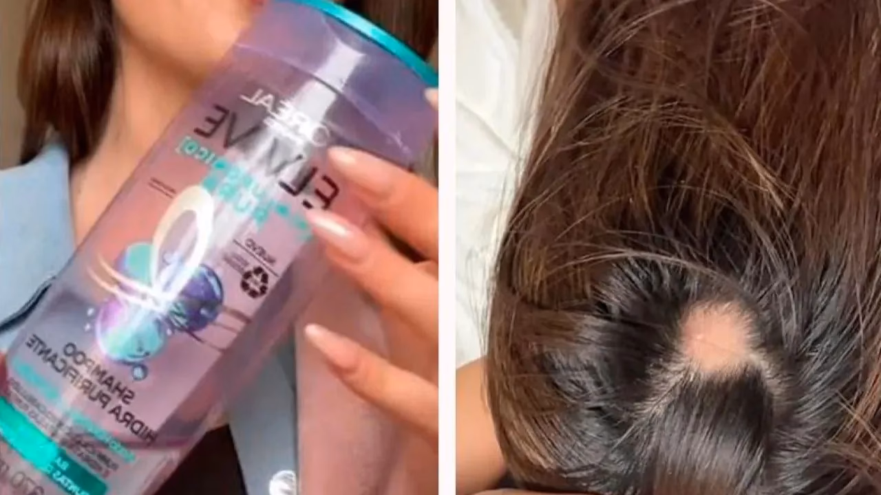¿Por qué Elvive es malo para tu cabello?
