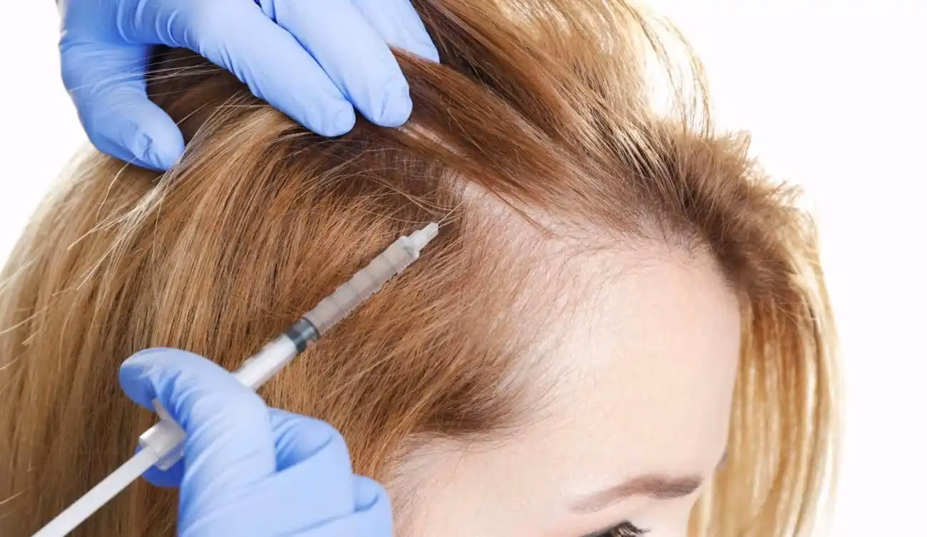 ¿Cuánto tarda en crecer el pelo con corticoides?