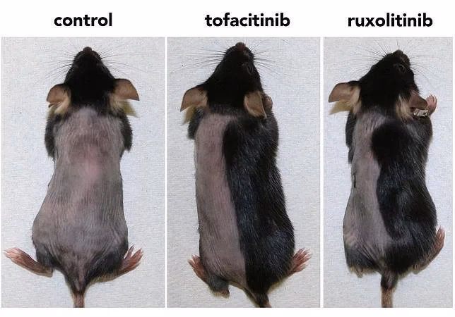 ¿Cuáles son los síntomas del virus de la rata en humanos?