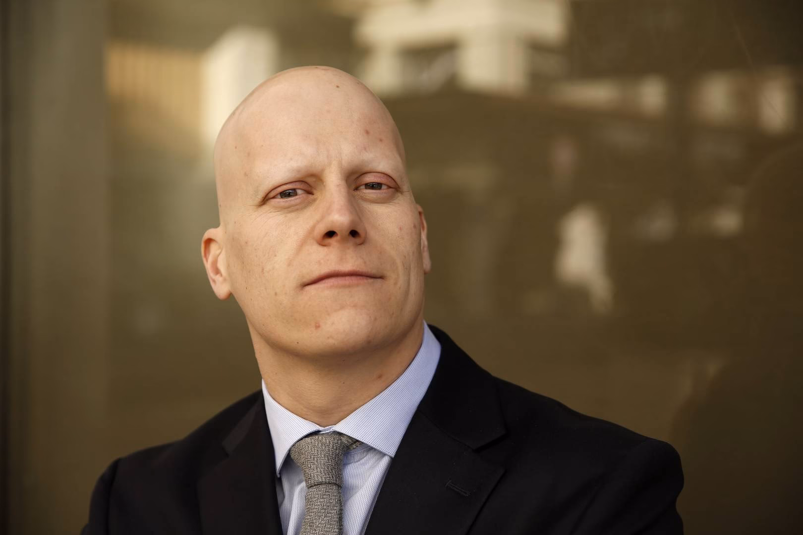 ¿Cómo se cura la alopecia universal?